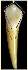<p><mark data-color="#ffc1ec" style="background-color: #ffc1ec; color: inherit">mandibular canines #22 and #27; cingulum</mark></p>