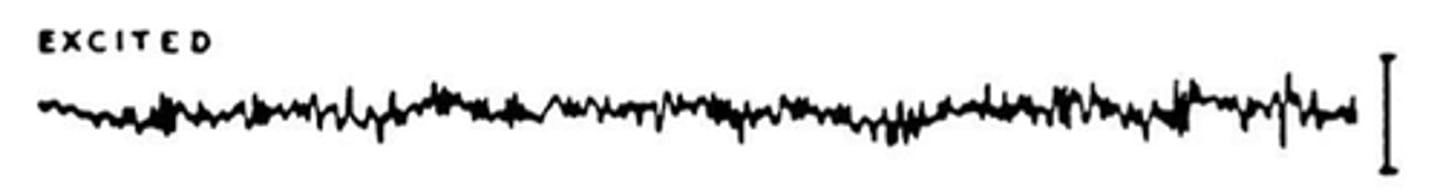 <p>mostly beta (alert) and some alpha (relaxed).</p>