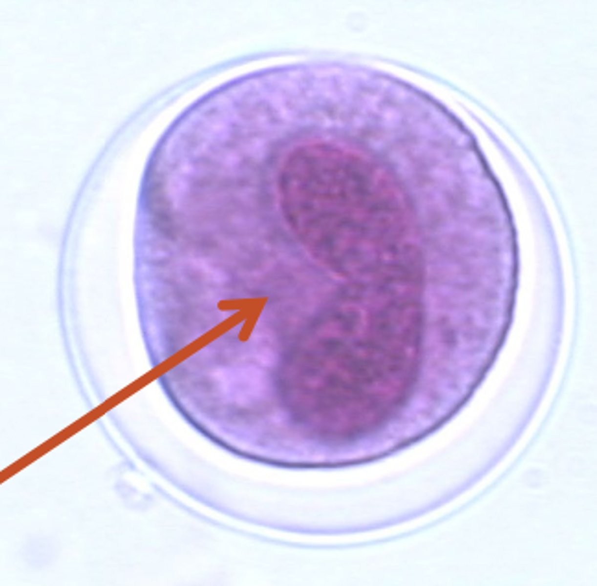<p>which protozoa has a kidney shaped nucleus in the cyst?</p>