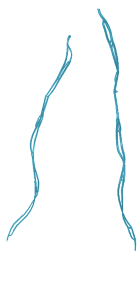 <p>generic term for a vein draining a reproductive organ</p>