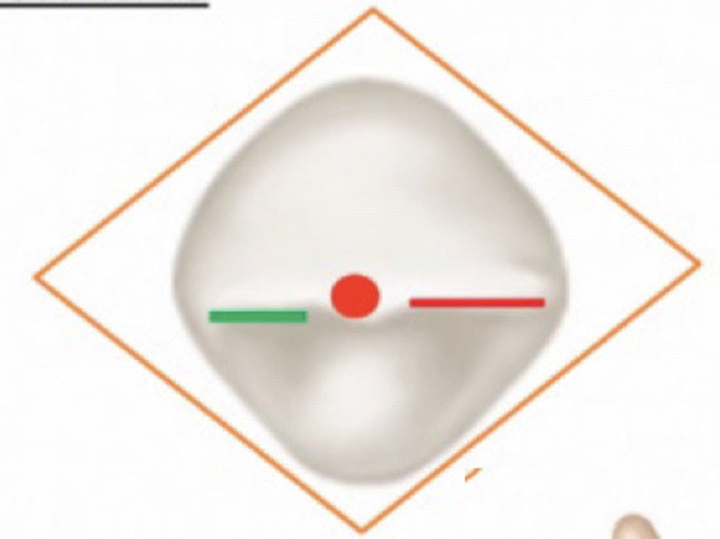 <p>- diamond in shape</p><p>- thickness &gt; width</p><p>- labial surface appears convex (more than incisors)</p><p>- cingulum forms short arc</p><p>- elev. and dep. in both labial + lingual surfaces appeared in this aspect</p><p>- cusp tips shifted 1mm labially (allow occlusion), 1mm mesially (bc distal cusp slope longer than mesial)</p>