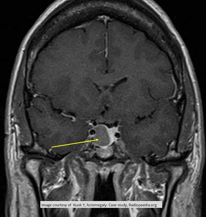 term image