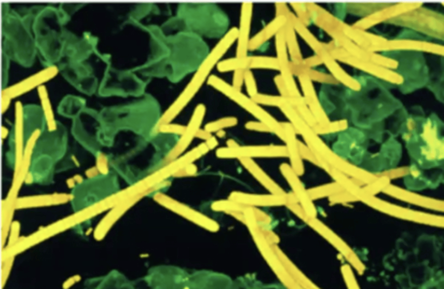 <p>What type of microscopy is shown?</p>