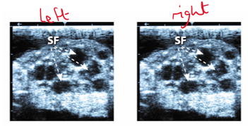 <p>You are presented with a cow that has not been seen bulling. On ultrasound, the left and right ovary appear as in the image. How do you suggest this animal is managed?</p>