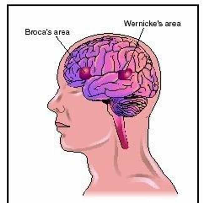 <p>loss of impairment to understand language or express oneself through language due to injury or illness</p>