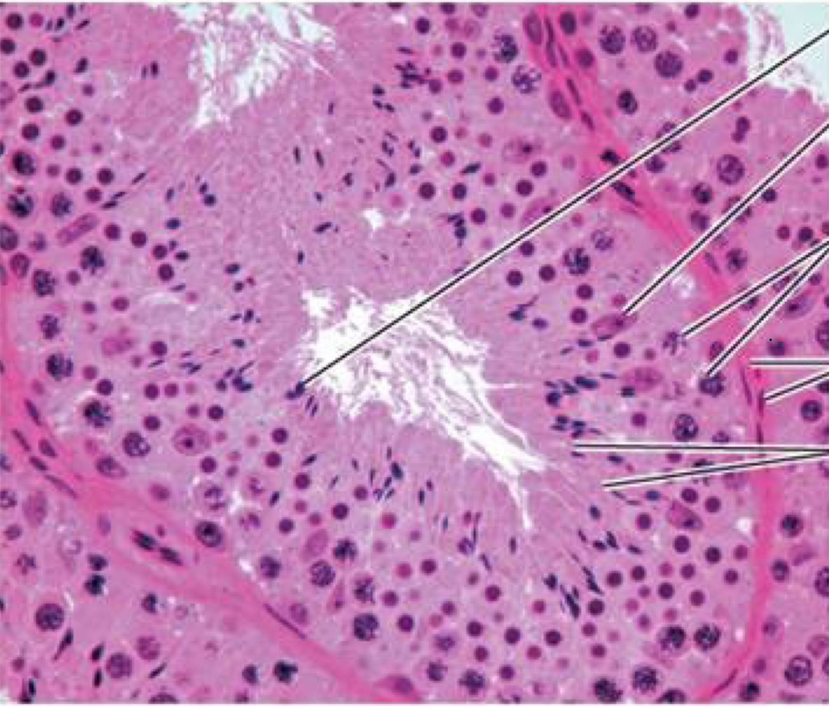 <p>Identify the following histology:</p>