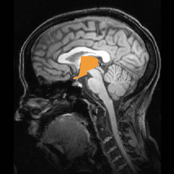 <p>thalamus and hypothalamus</p>