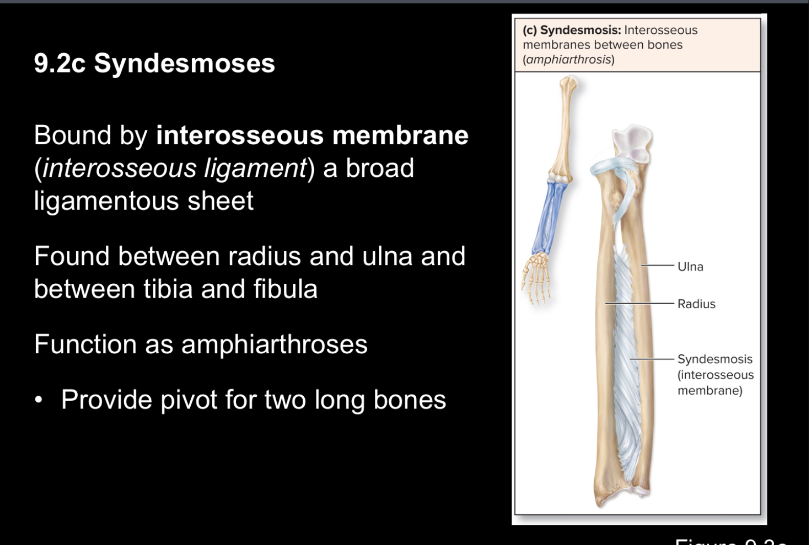 <p>Interosseous membranes between bones (Amphiarthrosis) ie ulna radius</p>