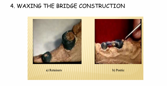 <p>What is the 4th step of preparing a model cast FPD?</p>