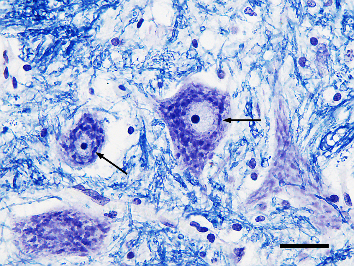 <p>Nissel bodies </p>