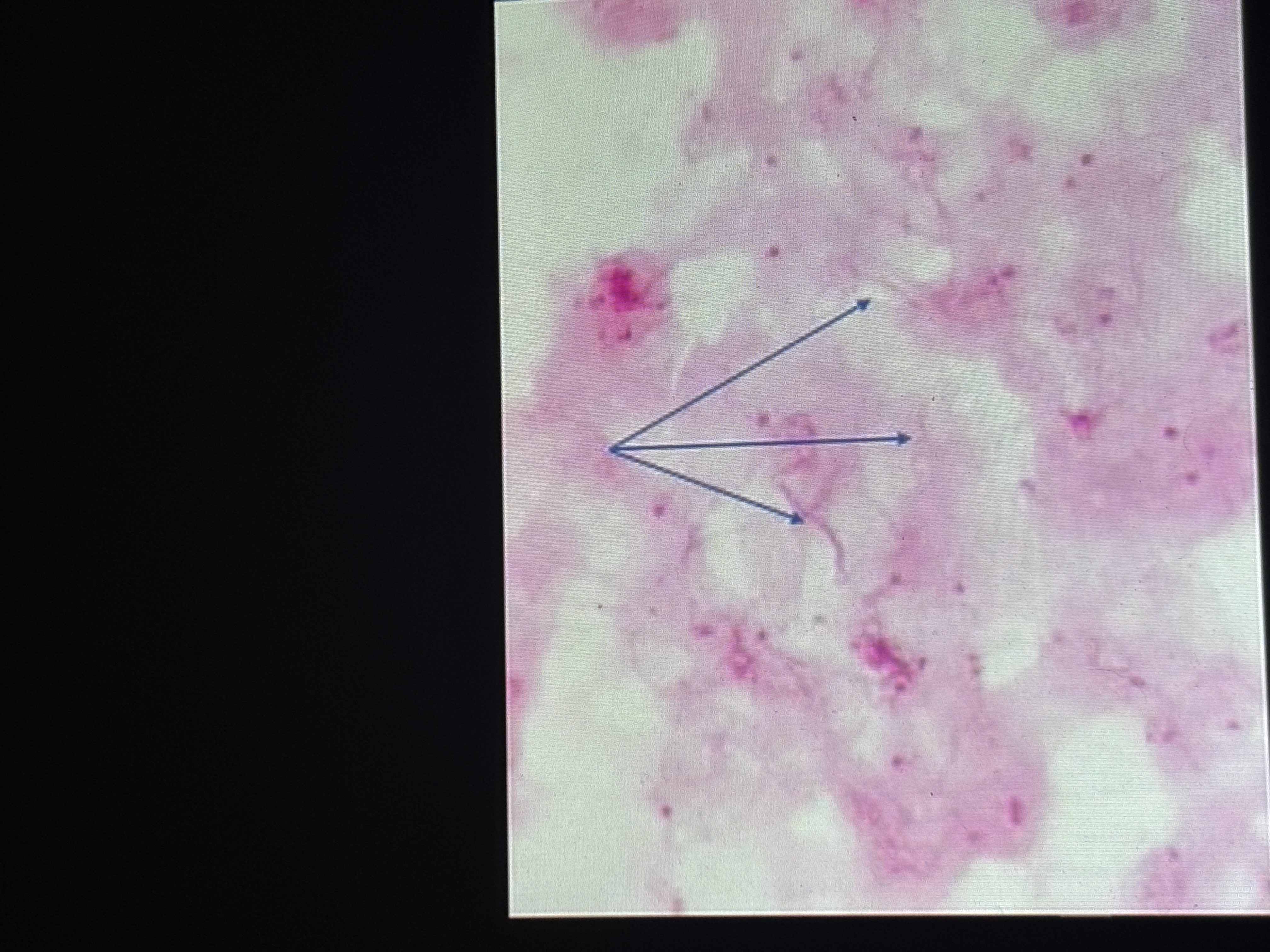 <p>Name the organism at the pointer</p><p>What is the name of the special structure involved in this groups movement</p><p>What disease does this organism cause</p><p>What are the symptoms of the first stage of disease it causes</p>