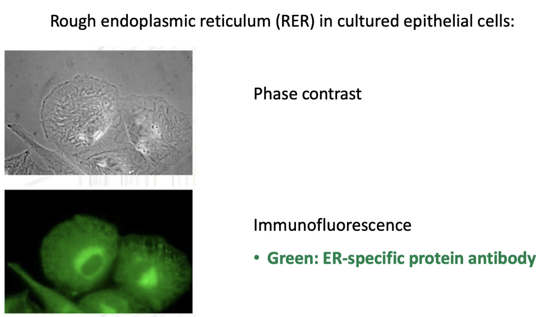 <ul><li><p><strong>Phase contrast microscopy:</strong></p><ul><li><p>Shows <strong>all cell membranes</strong>.</p></li><li><p>Provides <strong>greater structural detail</strong>.</p></li></ul></li><li><p><strong>Immunofluorescence microscopy:</strong></p><ul><li><p>Uses <strong>antibody specific to ER protein</strong>.</p></li><li><p>Highlights <strong>only the ER membranes</strong>.</p></li><li><p>Allows <strong>targeted visualization</strong> of ER.</p></li></ul></li></ul><p></p>