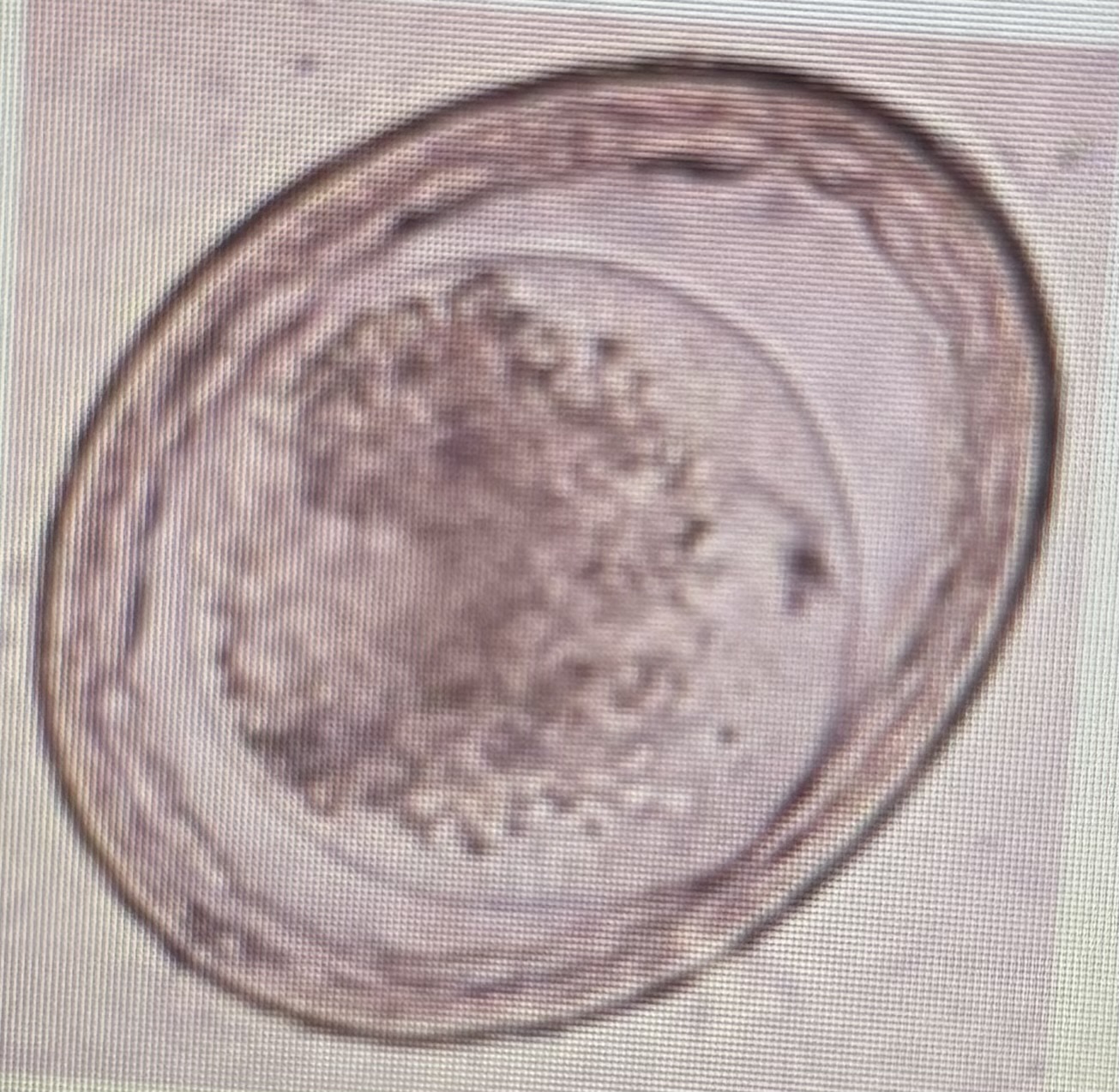 <p>Ascarid </p><p>Host species: dog and cat</p><p>Size: 75-85 um </p><p>Prepatent period: 77 days </p><p>Transmission: ingestion trans placental </p><p>Does not have zoonotic potential </p>