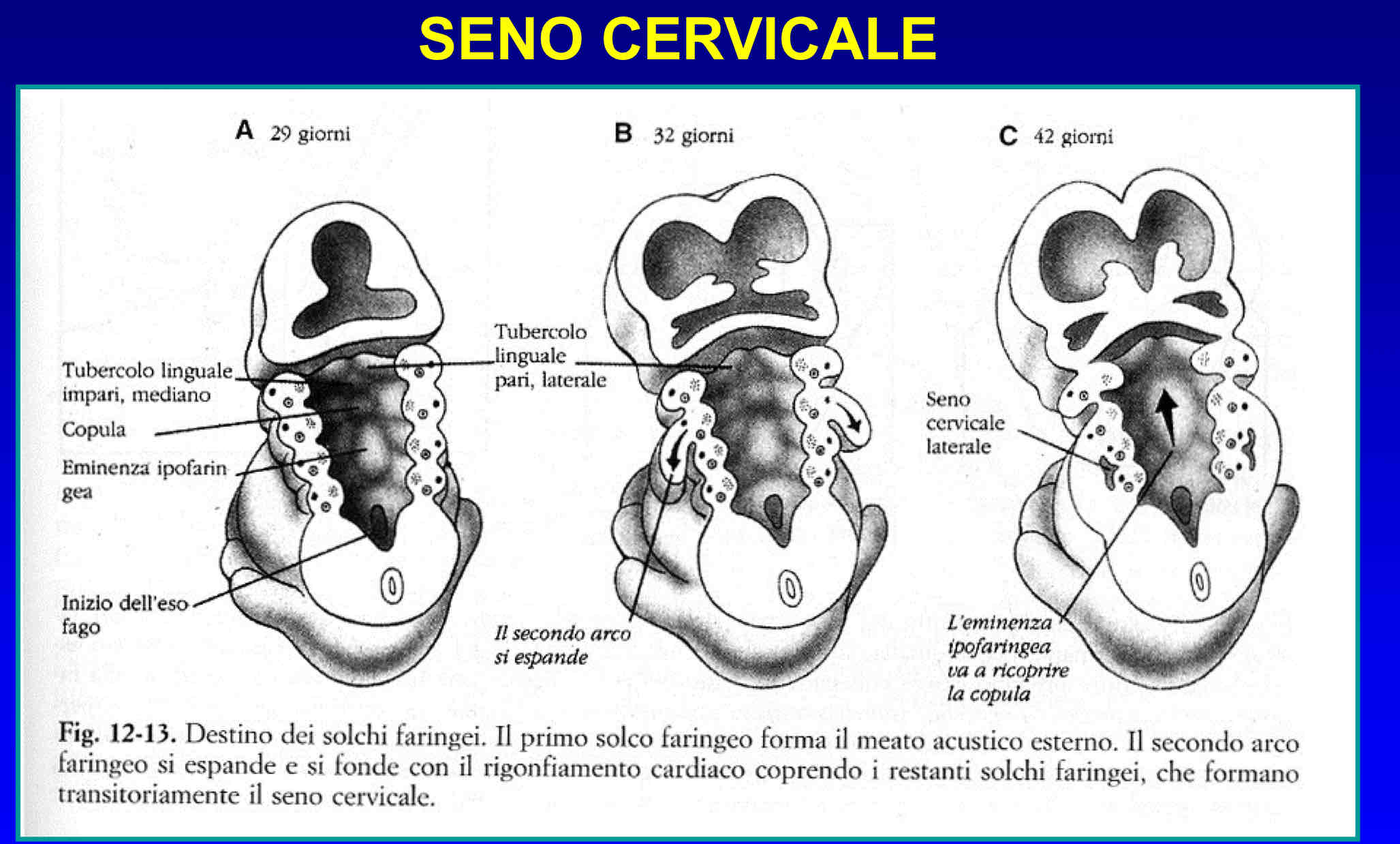 <p>Margine caudale del secondo arco faringeo prolifera e forma un lembo di tessuto che ricopre gli archi posti caudalmente e si fonde con la bozza cardiaca.</p><p>Fra l’ectoderma di rivestimento del lembo e quello di rivestimento degli archi si forma il seno cervicale, una fessura che poi andrà a scomparire.</p>