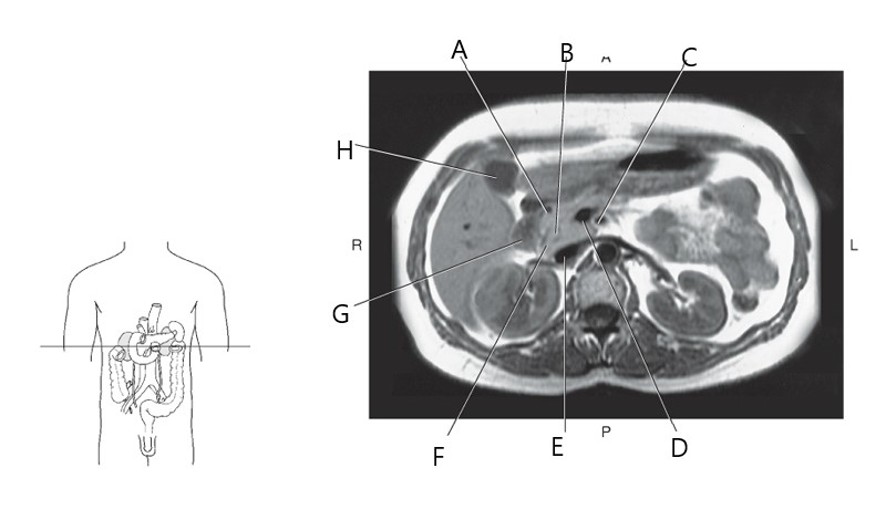 <p>G</p>