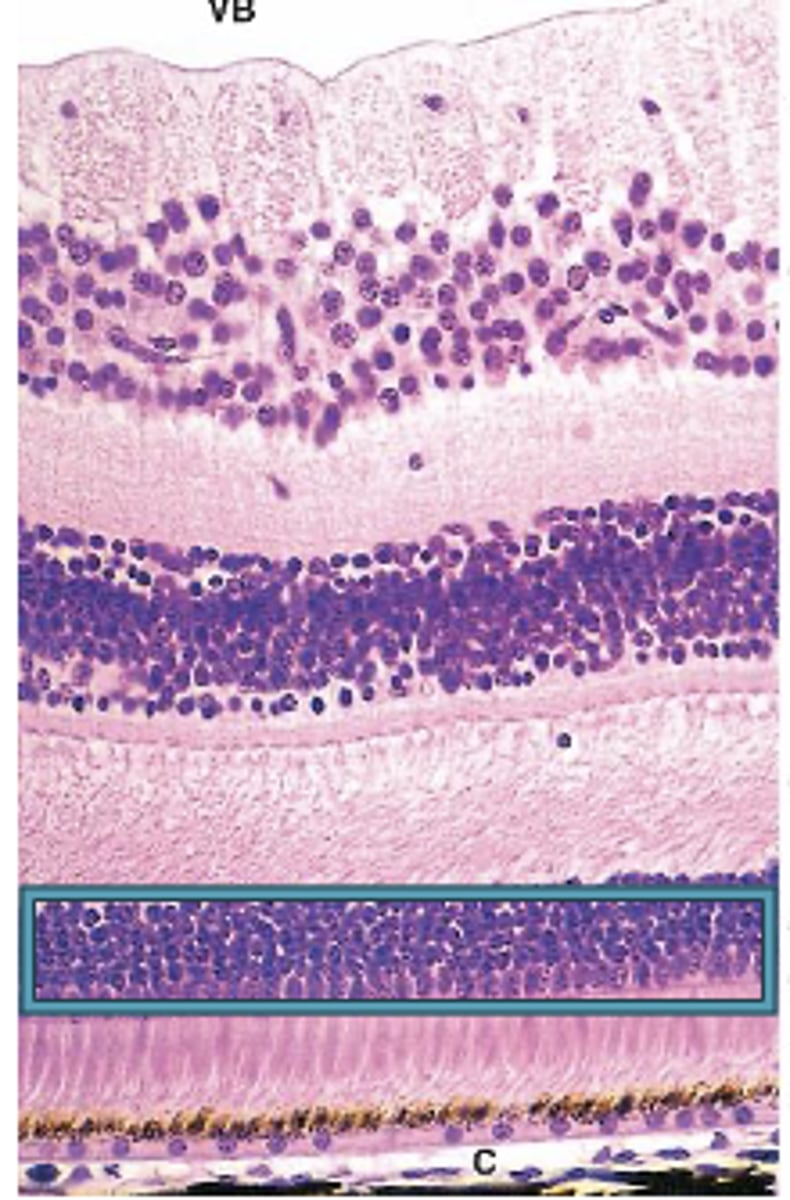 <p>Identify the Layers of the neural retina</p>