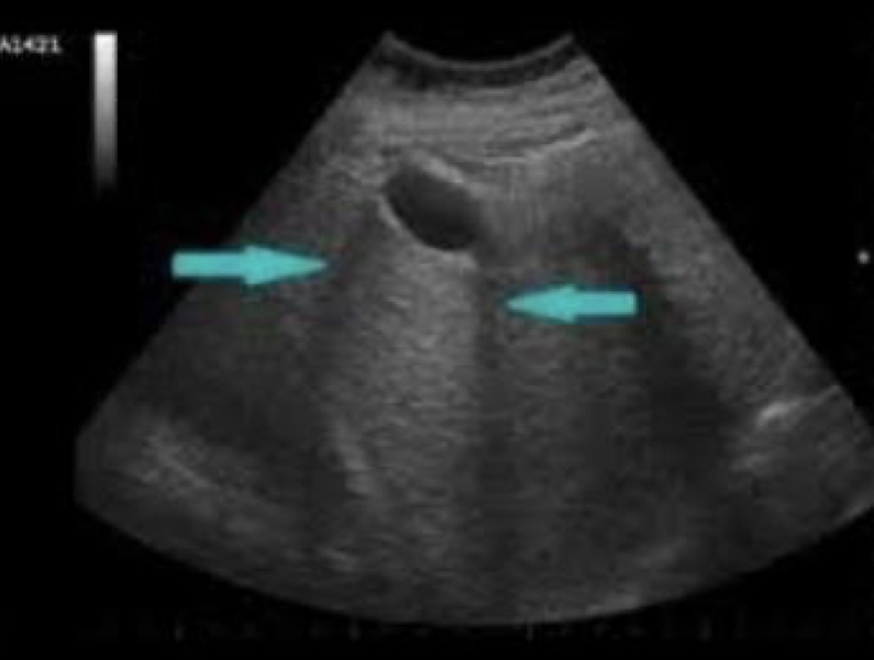 <p>What artifact is this showing?</p>