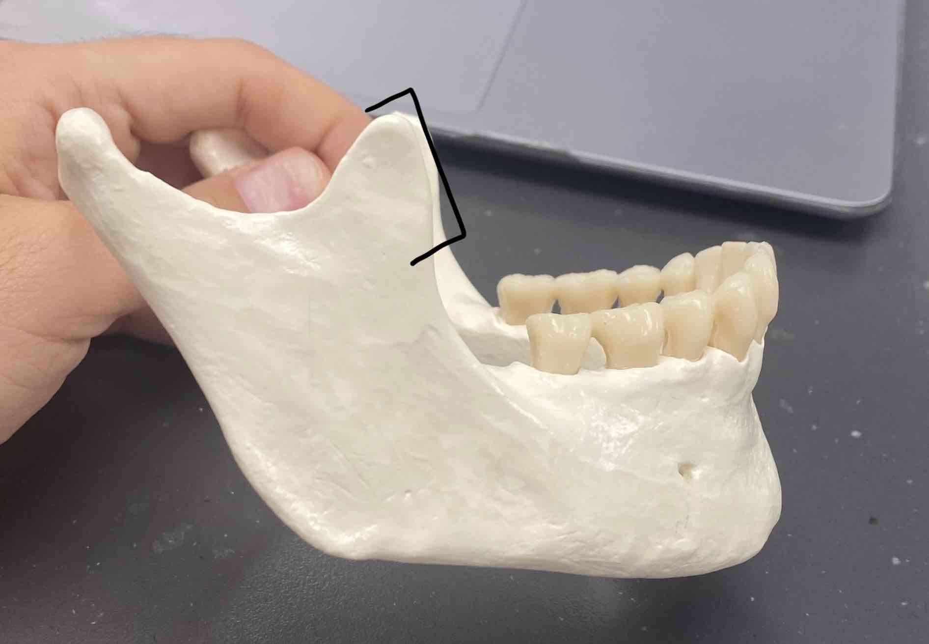 <p><span>name the bone and landmark</span></p>