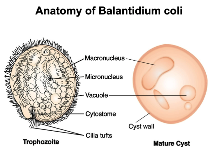 <p>intestinal cilitate: movement, two nuclei (macro and micro), sexual and asexual production</p><p>disease: balantidiosis — infection in intestinal mucosa</p><p>natural habitat: large intestines of pigs, other domestic animals, primates (cysts in feces)</p>