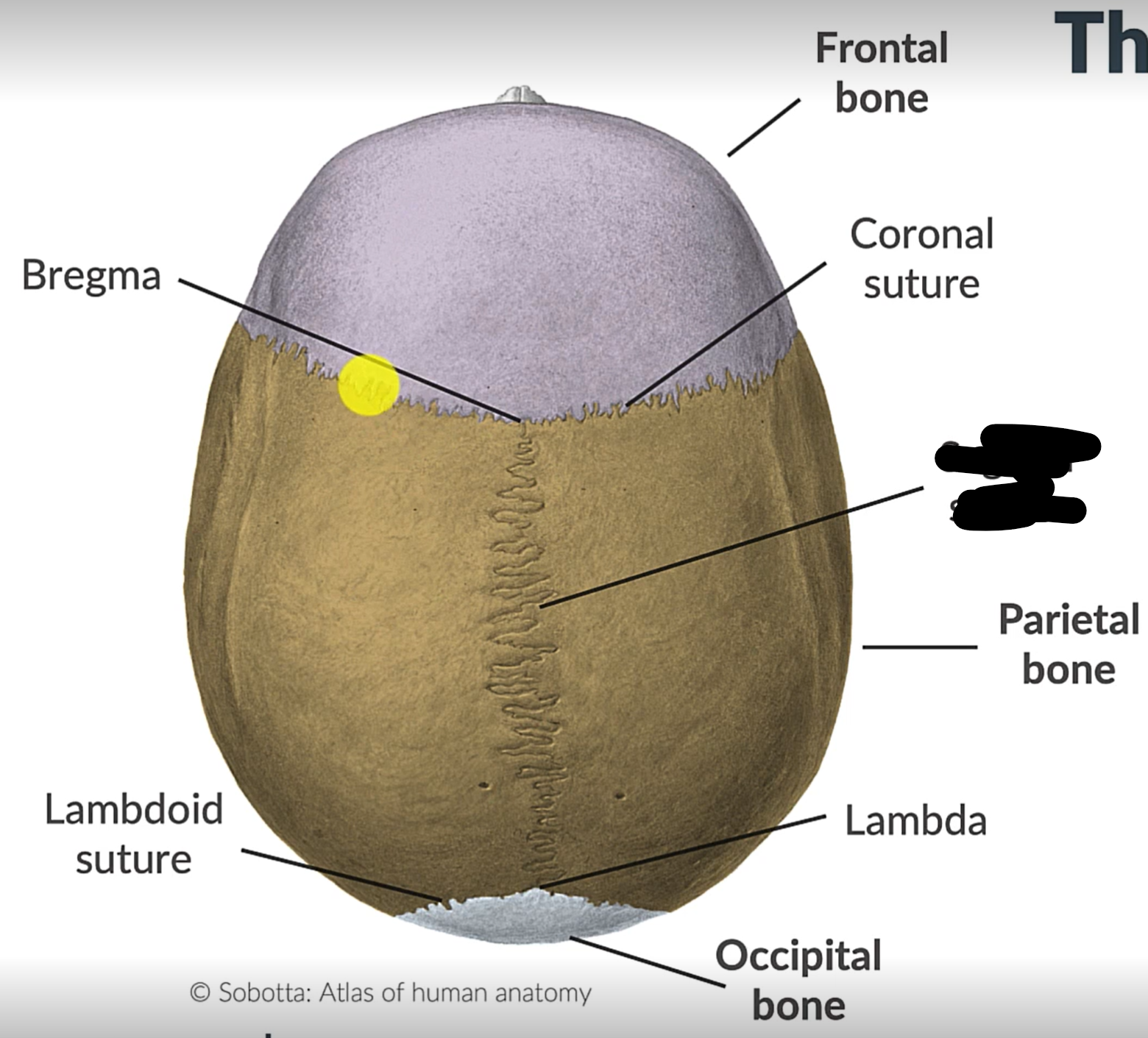 term image