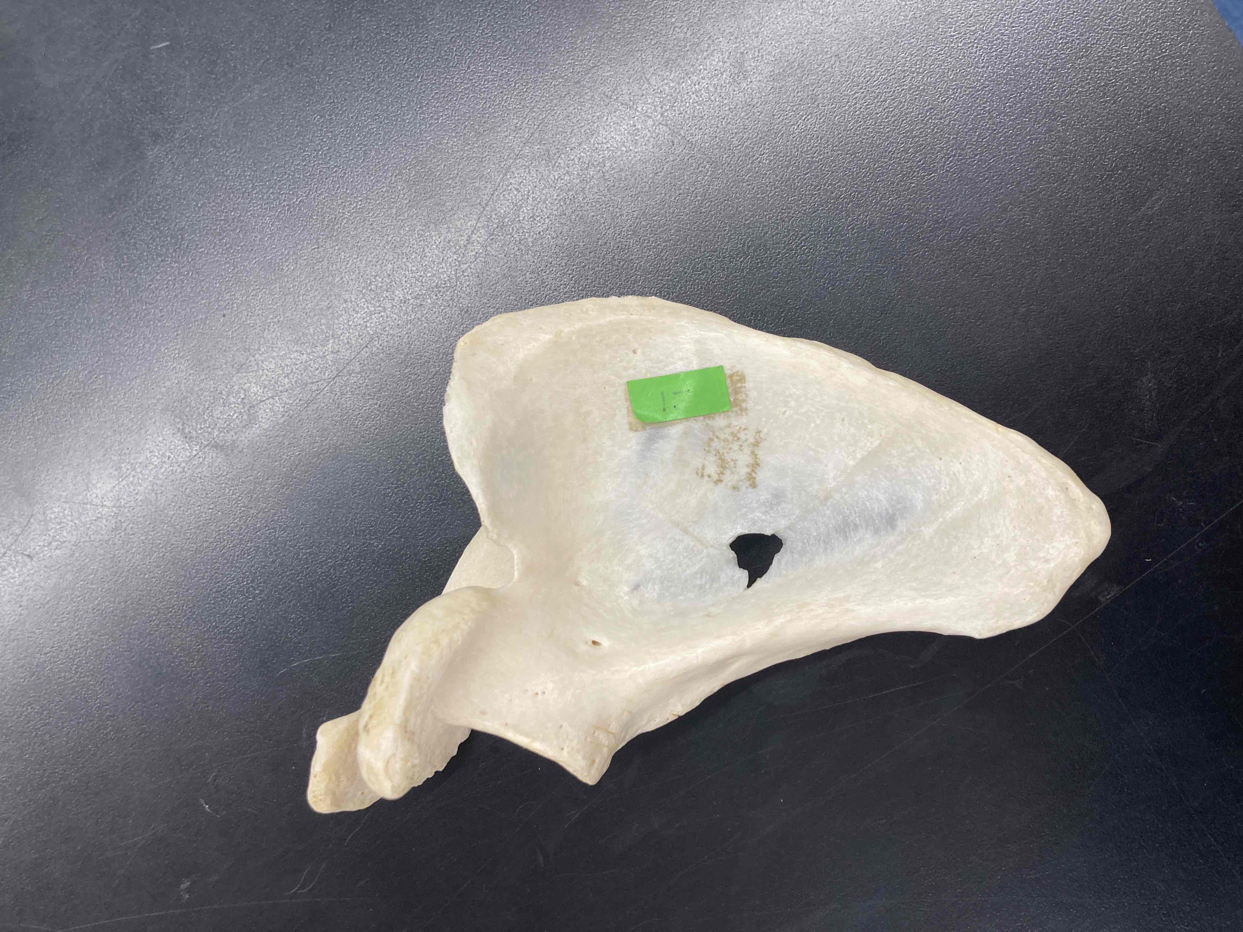 <p>What is the name of this bone?</p>