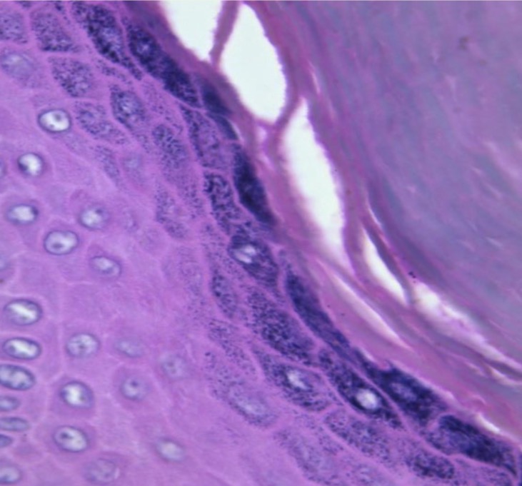 <p>Queratinocitos del estrato granuloso </p>