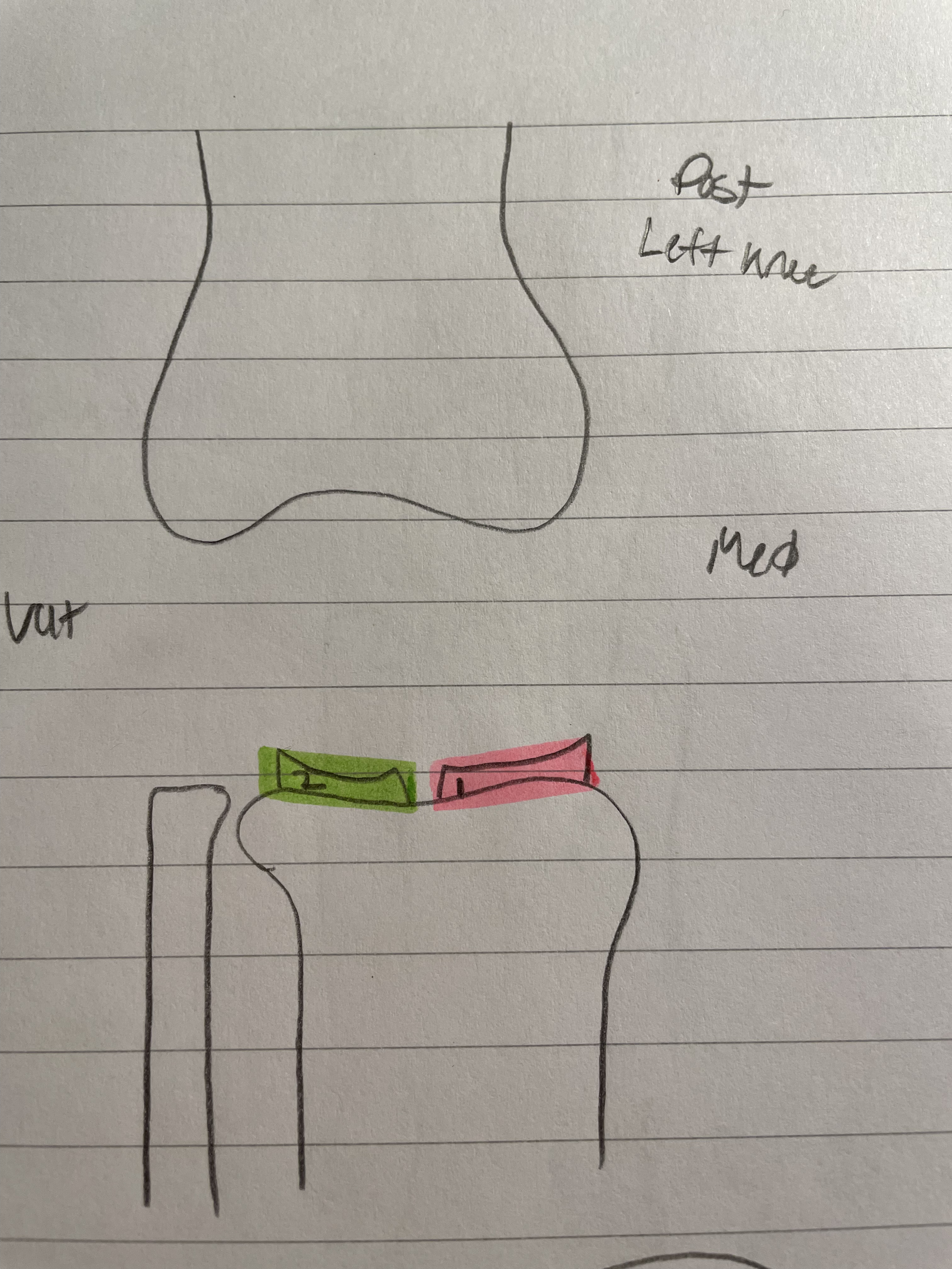 <ol start="2"><li><p><span style="color: green">Lateral</span> Meniscus</p></li></ol>