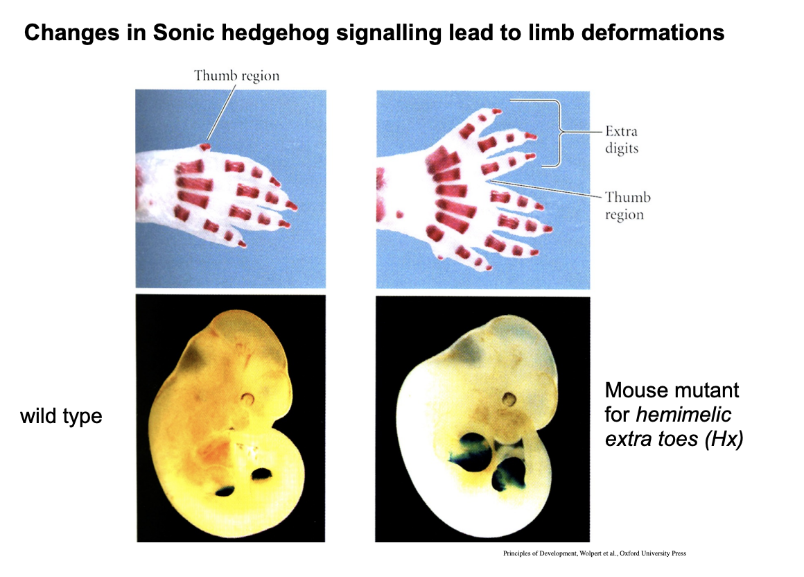 <p>→ Sonic Hedgog synthesised by the cells in this region</p>