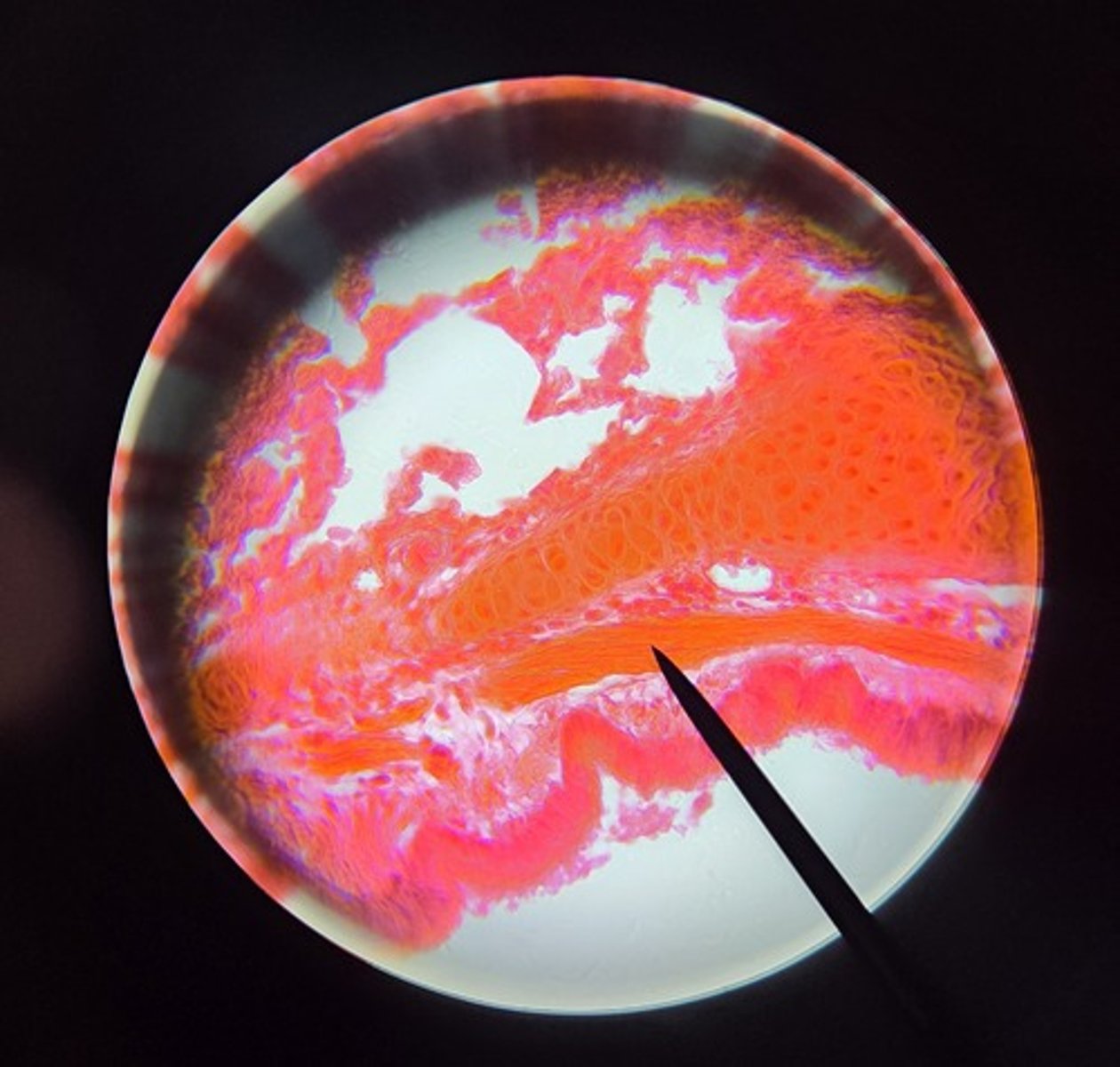<p>What is this tissue? (In spirals, not rings)</p>