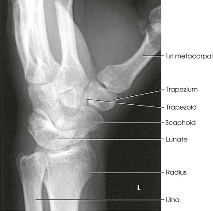 term image
