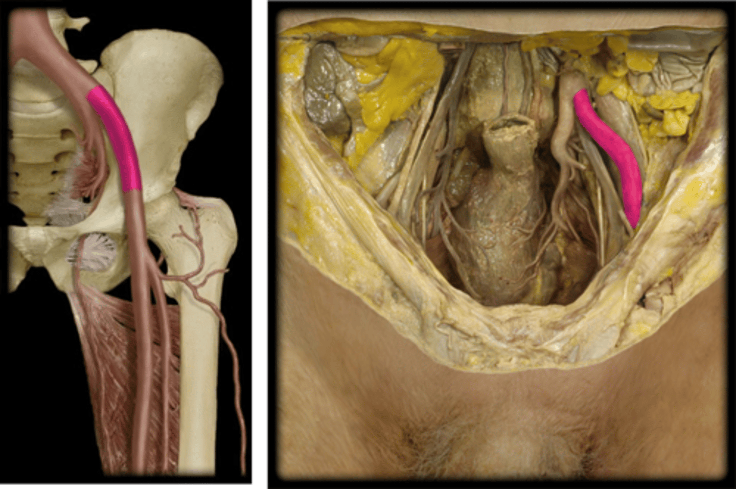 <p>Name this vessel.</p>