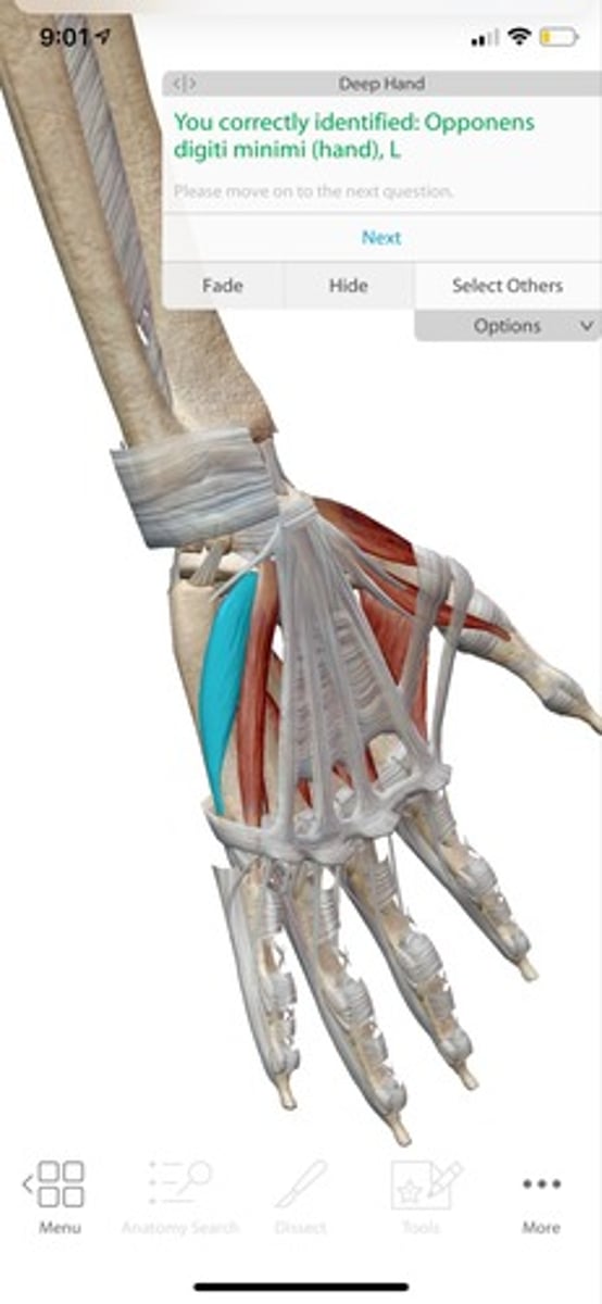 knowt flashcard image