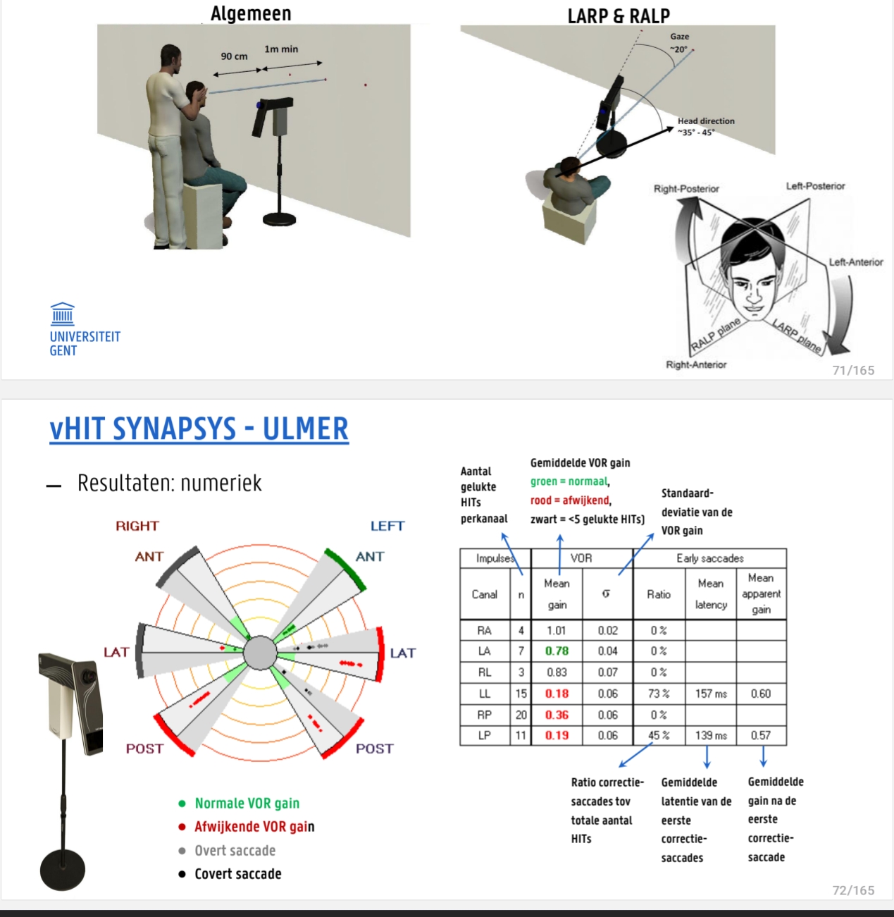 <p>Veel bij kindjes</p><p>LARP = links ateriuer</p><p>RALP= recht anterieur en links posterieru (naar links gedraaid dus)</p><p>n = antal keer dat de test gedaan is</p><p>dichter bij cirkel = betere gain = meer naar buiten is&nbsp;‘slechter’</p><p>saccades te zien int grijs = vaak hogere gain daarbij</p><p>standaarddeviatie → moet zo laag mogelijk zijn</p><p>(2de kolommeke&nbsp;‘early saccades’ minder belangrijk)</p><p></p>