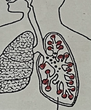<p>The Alveoli</p>