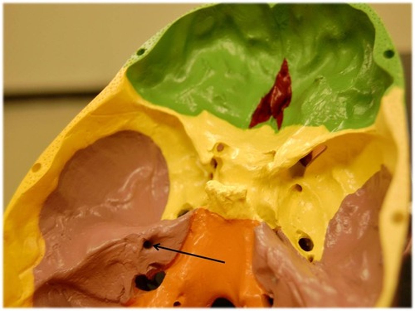 <p>Temporal bone - inner ear canal</p>