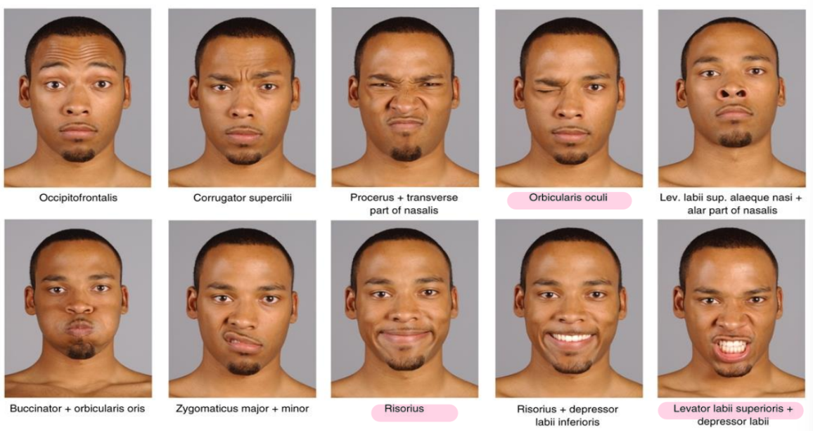 <ul><li><p>occipitofrontalis: haussement de sourcil</p></li><li><p>orbicularis oculi : clin d’oeil</p></li><li><p>risorius: souris forcé</p></li><li><p>levator labii superioris</p></li></ul><p>paralysie de Bell est la paralysie de ces muscles</p>