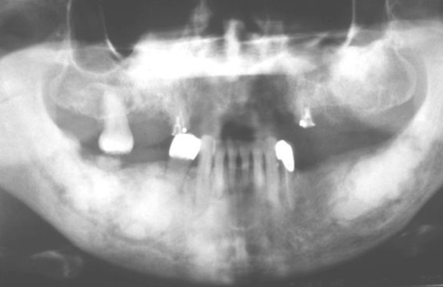 <p>Mandible and maxilla, anterior teeth</p>