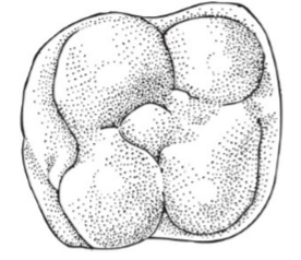 <p>What type of tooth is this?</p>