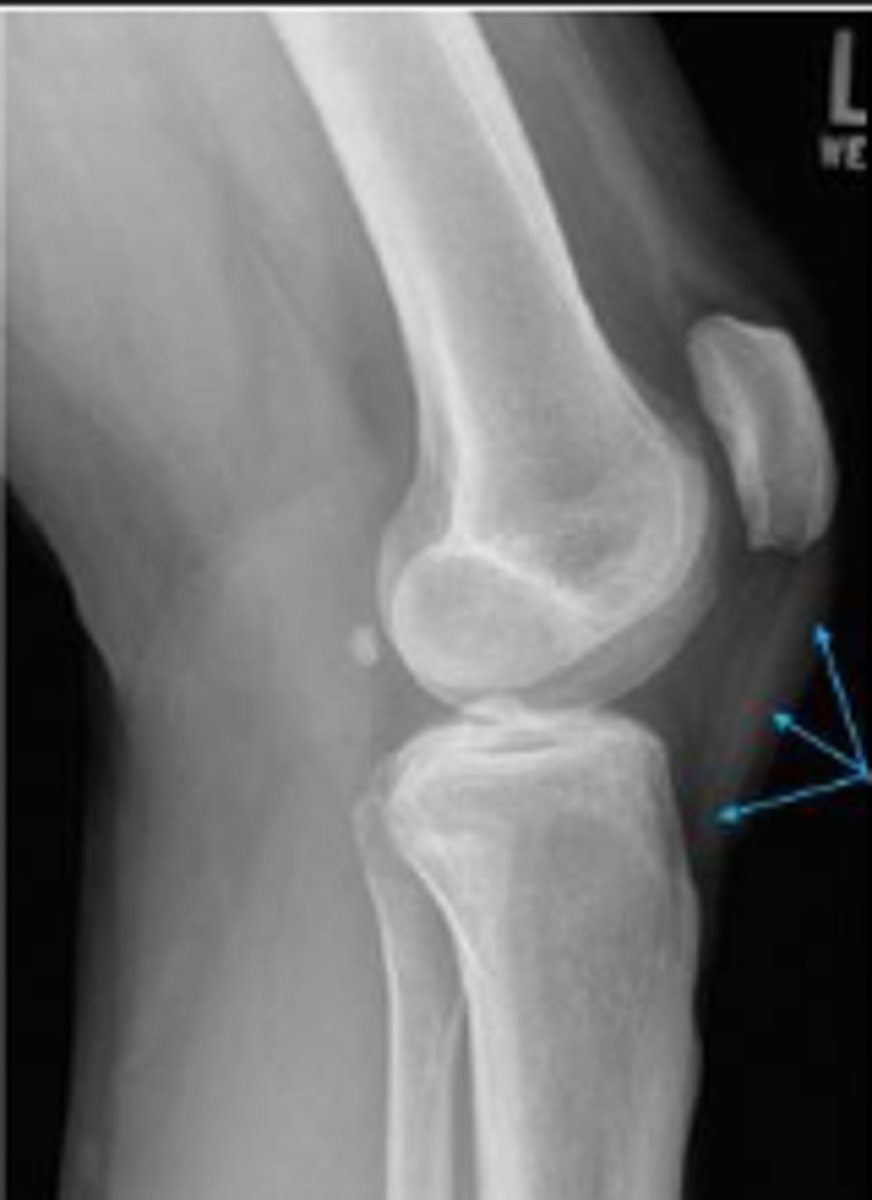 <p>What are the arrows pointing to?</p>