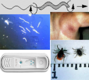 Initial ELISA or IFA, confirmed with Western Blot