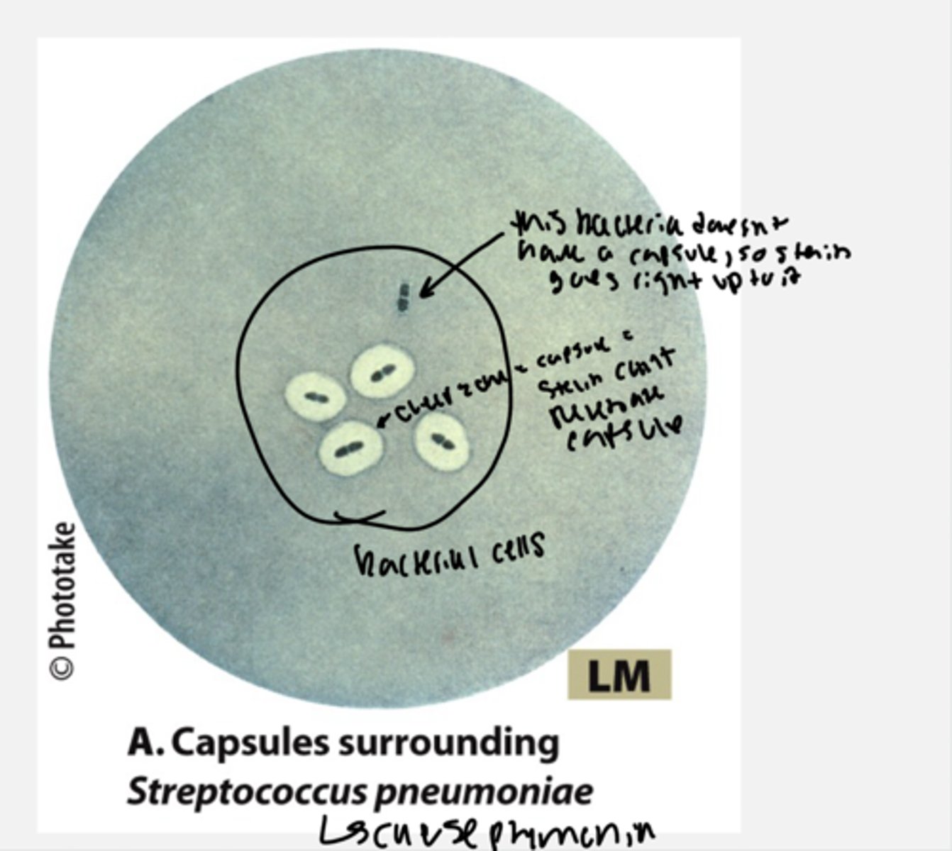 <p>- in bacteria that have capsules, the stain cannot penetrate the capsule and they have a big white glob around them. if a bacteria does not have a casule, the stain goes right up to the bacteria</p>