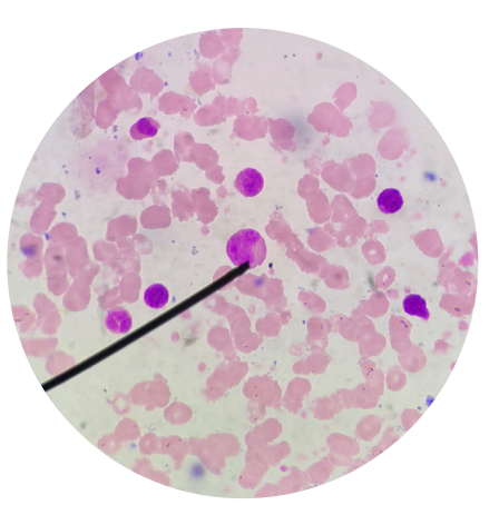 <p>what kind of white blood cells is this?</p>