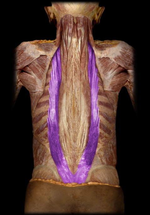 <ul><li><p>Action: Unilateral: lateral flexion of vertebral column, Bilateral: extension of vertebral column, Depression of ribs</p></li><li><p>Origin: Common origin and ribs</p></li><li><p>Insertion: Ribs, Transverse processes (cervical)</p></li><li><p>Innervation: Dorsal rami of spinal nerves</p></li></ul><p></p>