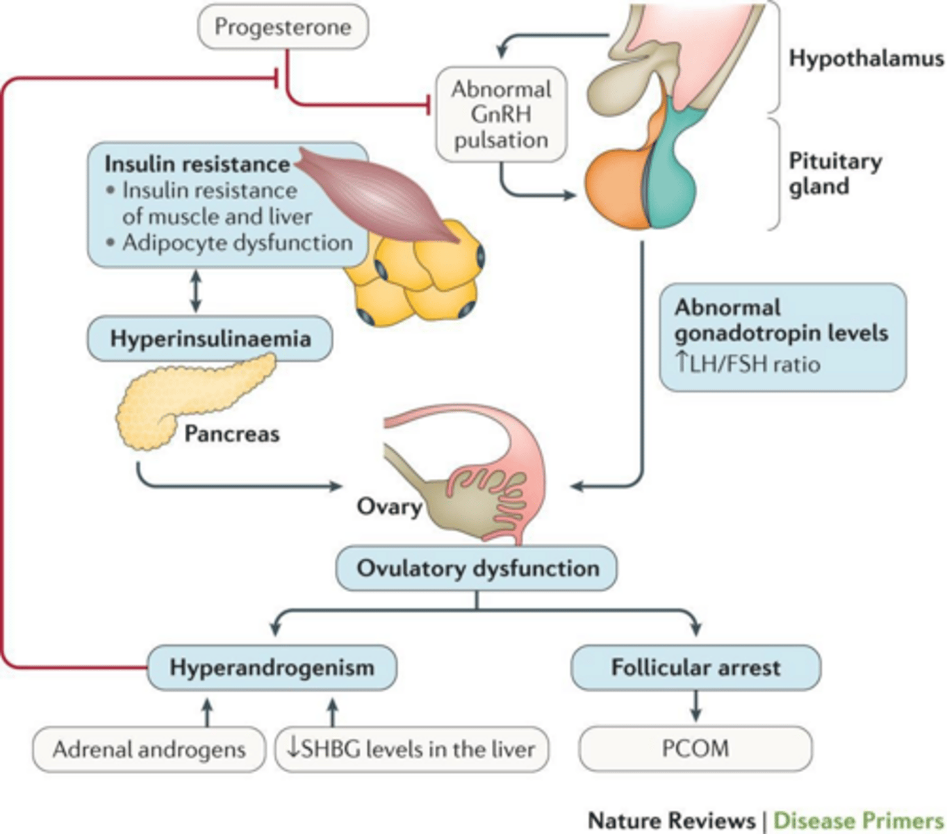 <p>Increased GnRH pulse frequency leads to elevated LH and a mismatched LH:FSH ratio (typically 2:1 or 3:1).</p>