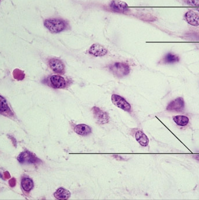 <p>what is the connective tissue?</p>