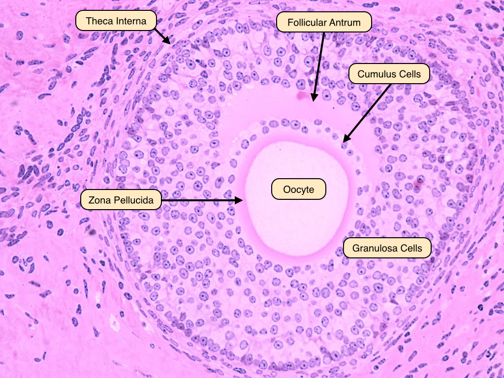 <p>antral cavity (fluid filled space) begins to seperate the oocyte and granulosa cells</p><p>Antrum is dependent on gonadotropinswhat are distinguishable features of a </p>