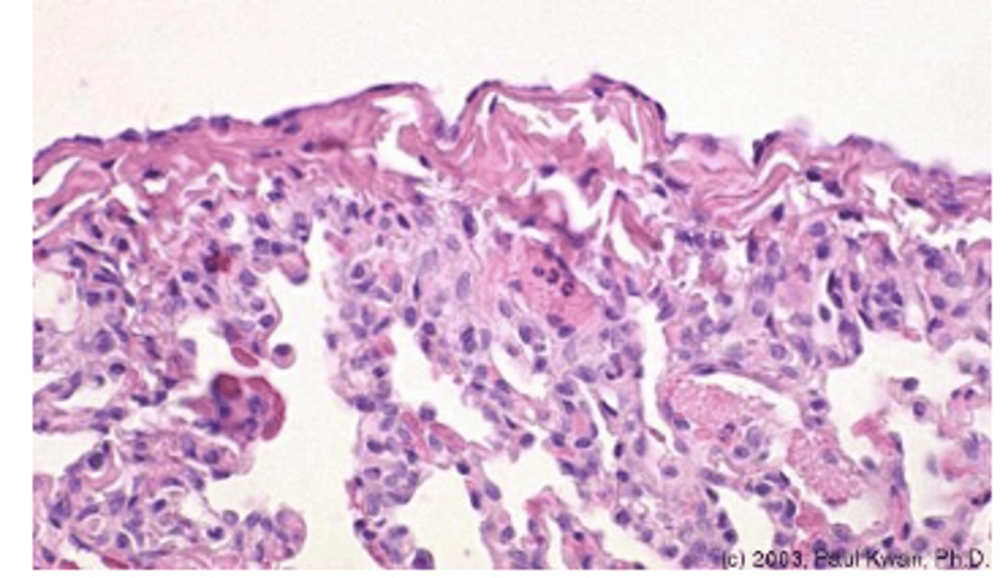 <p>Internal non free surface type</p><p>- lines organs (serous membranes)</p><p>- visceral vs. parietal layers</p><p>- heart (pericardium), lungs (pleura), viscera (peritoneum)</p>