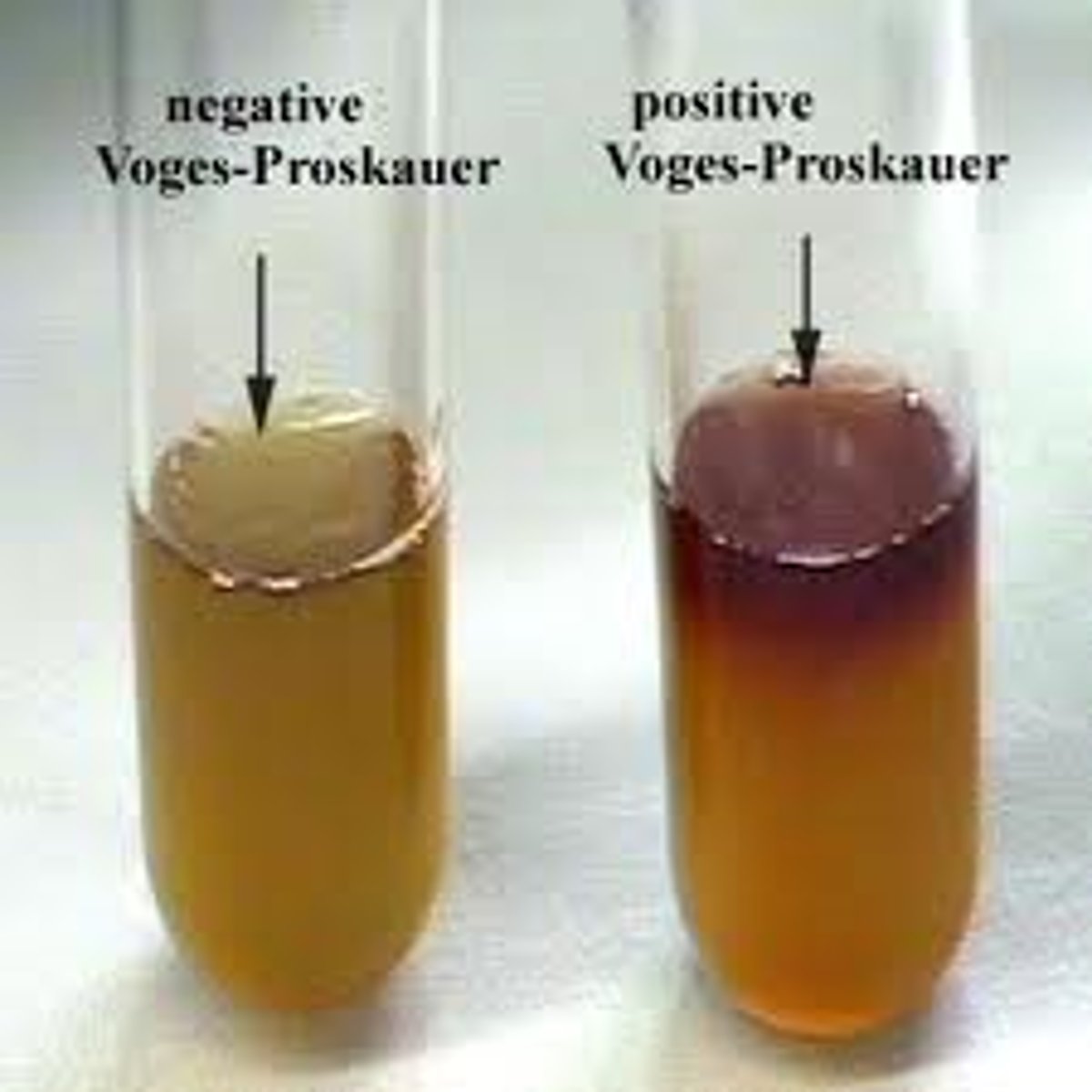 <p>The organism does not produce acetoin, so the broth shows no color change after adding reagents.</p>