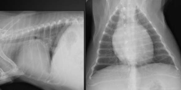 <p>What are the radiographic findings?</p><p>Diagnosis?</p>