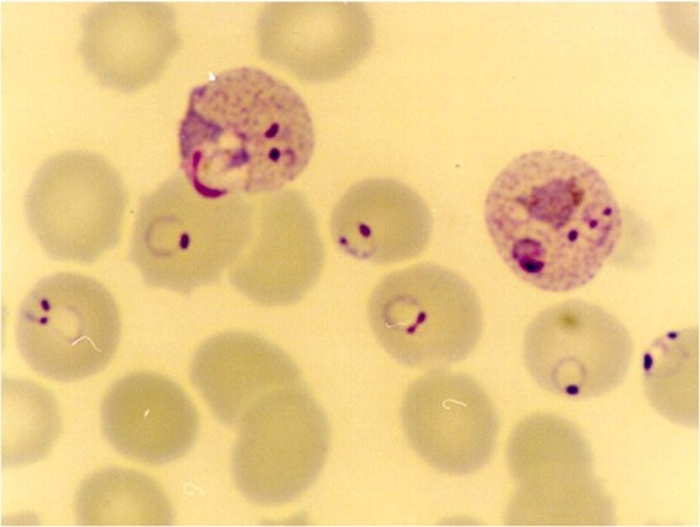<p>infects reticulocytes with duffy antigens present</p><p>-trophozoites cause ring forms in RBCs</p><p>-infected RBCs appear enlarged</p><p>-schuffner's stippling and ameboid appearance in infected RBCs</p><p>-schizonts visible in thin smears</p><p>-merezoites cause formation of brown hemozoin pigment</p>